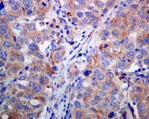Immunohistochemistry (Formalin/PFA-fixed paraffin-embedded sections) - Anti-BIVM antibody [EPR9109] (AB137113)