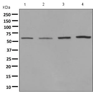 Western blot - Anti-BIVM antibody [EPR9109] - BSA and Azide free (AB248827)