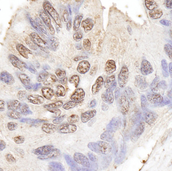 Immunohistochemistry (Formalin/PFA-fixed paraffin-embedded sections) - Anti-BLAP75 antibody (AB70525), expandable thumbnail