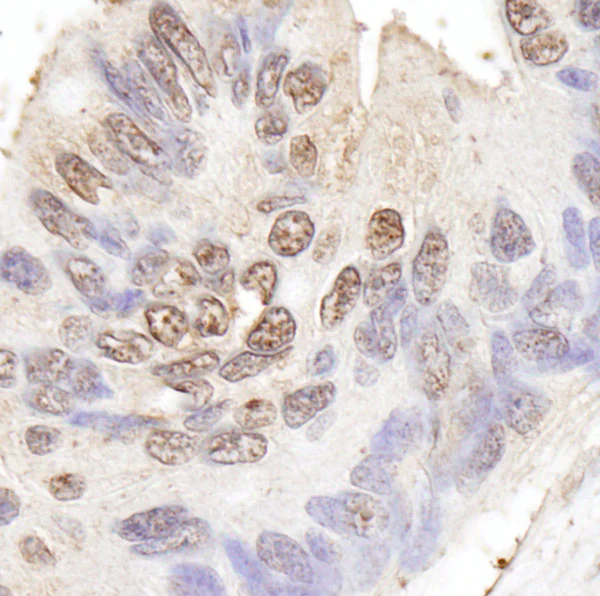 Immunohistochemistry (Formalin/PFA-fixed paraffin-embedded sections) - Anti-BLAP75 antibody (AB70525)