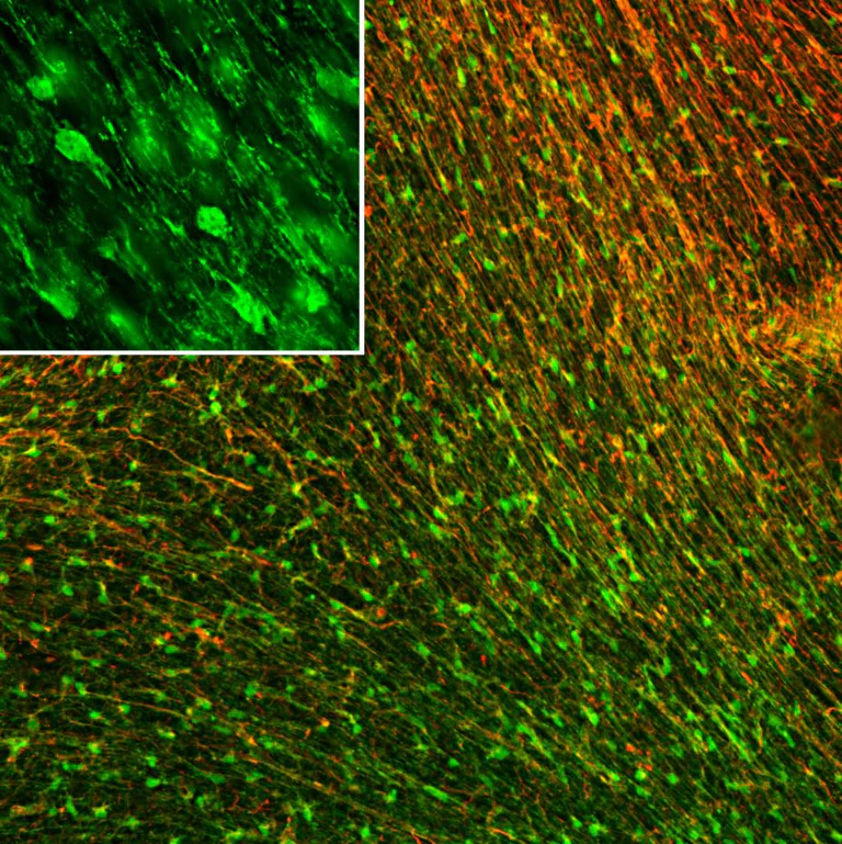 Immunohistochemistry - Anti-BLBP antibody [2A84] (AB277622)