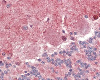 Immunohistochemistry (Formalin/PFA-fixed paraffin-embedded sections) - Anti-BLBP antibody (AB110099)
