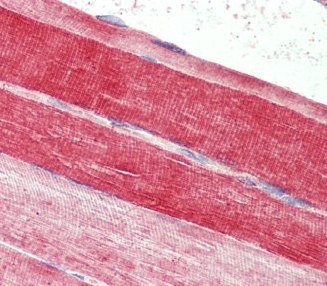 Immunohistochemistry (Formalin/PFA-fixed paraffin-embedded sections) - Anti-BLBP antibody (AB110099)