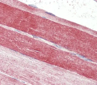 Immunohistochemistry (Formalin/PFA-fixed paraffin-embedded sections) - Anti-BLBP antibody (AB110099)