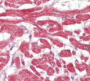 Immunohistochemistry (Formalin/PFA-fixed paraffin-embedded sections) - Anti-BLBP antibody (AB110099)