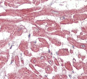 Immunohistochemistry (Formalin/PFA-fixed paraffin-embedded sections) - Anti-BLBP antibody (AB110099)