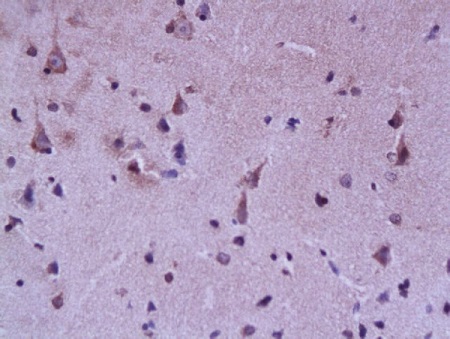 Immunohistochemistry (Formalin/PFA-fixed paraffin-embedded sections) - Anti-BLBP antibody (AB216635)