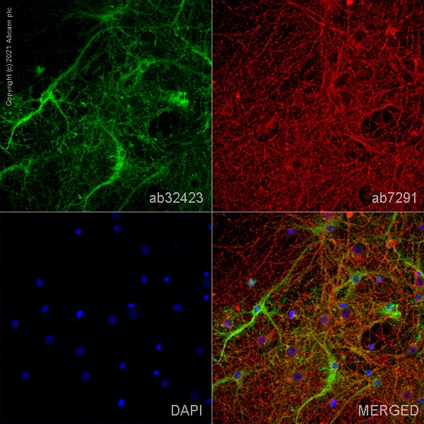 Immunocytochemistry/ Immunofluorescence - Anti-BLBP antibody (AB32423), expandable thumbnail