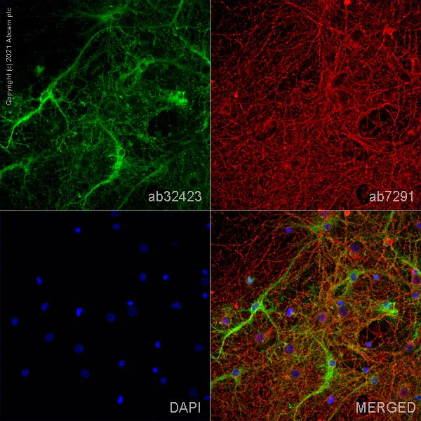 Immunocytochemistry/ Immunofluorescence - Anti-BLBP antibody (AB32423)