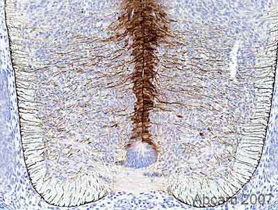 Immunohistochemistry (Formalin/PFA-fixed paraffin-embedded sections) - Anti-BLBP antibody (AB32423), expandable thumbnail