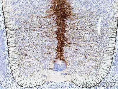 Immunohistochemistry (Formalin/PFA-fixed paraffin-embedded sections) - Anti-BLBP antibody (AB32423)