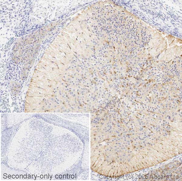 Immunohistochemistry (Formalin/PFA-fixed paraffin-embedded sections) - Anti-BLBP antibody (ab32423), expandable thumbnail