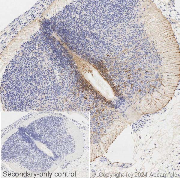 Immunohistochemistry paraffin embedded sections - Anti-BLBP antibody (ab32423), expandable thumbnail