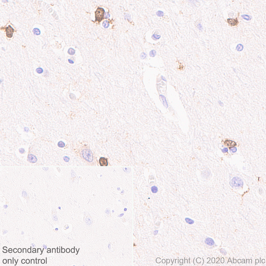 Immunohistochemistry (Formalin/PFA-fixed paraffin-embedded sections) - Anti-BLBP antibody [EPR24033-13] (AB279649), expandable thumbnail
