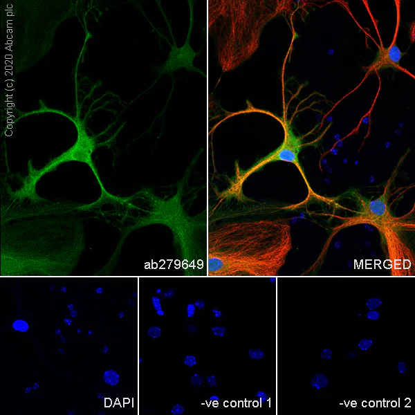 Immunocytochemistry/ Immunofluorescence - Anti-BLBP antibody [EPR24033-13] - BSA and Azide free (AB279652)
