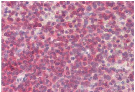 Immunohistochemistry (Formalin/PFA-fixed paraffin-embedded sections) - Anti-BLK antibody - N-terminal (AB189320)
