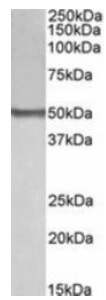 Western blot - Anti-BLK antibody - N-terminal (AB189320), expandable thumbnail