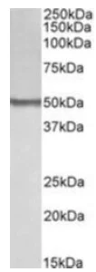 Western blot - Anti-BLK antibody - N-terminal (AB189320)