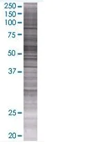 SDS-PAGE - BLK overexpression 293T lysate (whole cell) (AB94100)