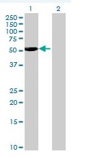 Western blot - BLK overexpression 293T lysate (whole cell) (AB94100)