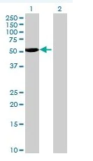 Western blot - BLK overexpression 293T lysate (whole cell) (AB94100)