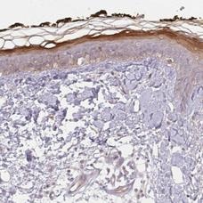 Immunohistochemistry (Formalin/PFA-fixed paraffin-embedded sections) - Anti-BLMH antibody (AB204584)