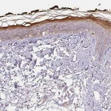 Immunohistochemistry (Formalin/PFA-fixed paraffin-embedded sections) - Anti-BLMH antibody (AB204584)
