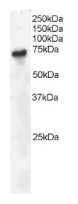 Western blot - Anti-BLNK antibody (AB2230)