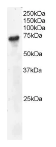 Western blot - Anti-BLNK antibody (AB2230)