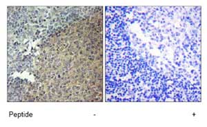 Immunohistochemistry (Formalin/PFA-fixed paraffin-embedded sections) - Anti-BLNK antibody (AB73706)