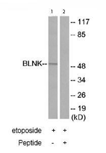 Western blot - Anti-BLNK antibody (AB73706)