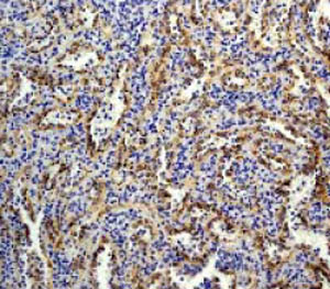 Immunohistochemistry (Formalin/PFA-fixed paraffin-embedded sections) - Anti-BLNK antibody [Y491] (AB32418), expandable thumbnail