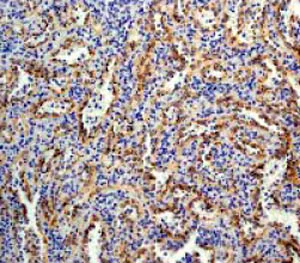 Immunohistochemistry (Formalin/PFA-fixed paraffin-embedded sections) - Anti-BLNK antibody [Y491] (AB32418)