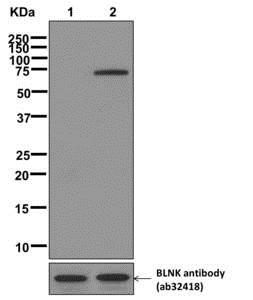 Western blot - Anti-BLNK (phospho Y84) antibody [EP2202(2)] - BSA and Azide free (AB284825)