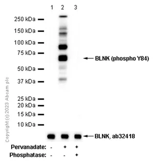 Western blot - Anti-BLNK (phospho Y84) antibody [EP2202(2)] - BSA and Azide free (AB284825)