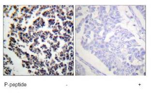 Immunohistochemistry (Formalin/PFA-fixed paraffin-embedded sections) - Anti-BLNK (phospho Y96) antibody (AB73204)