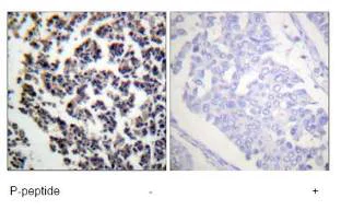 Immunohistochemistry (Formalin/PFA-fixed paraffin-embedded sections) - Anti-BLNK (phospho Y96) antibody (AB73204)