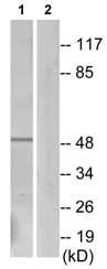 Western blot - Anti-BLNK (phospho Y96) antibody (AB73204)
