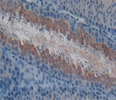 Immunohistochemistry (Formalin/PFA-fixed paraffin-embedded sections) - Anti-Blood Group Kell Antigen antibody (AB231602)