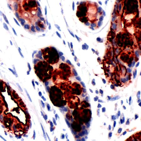 Immunohistochemistry (Formalin/PFA-fixed paraffin-embedded sections) - Anti-Blood Group Lewis a antibody [SPM 522] (AB231432)