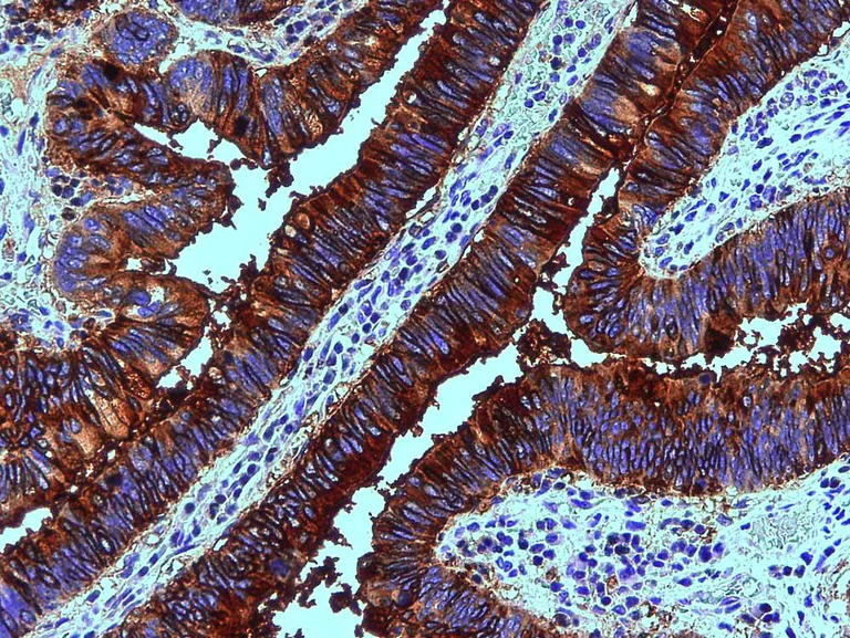 Immunohistochemistry (Formalin/PFA-fixed paraffin-embedded sections) - Anti-Blood Group Lewis b antibody [2-25LE] (AB3968)