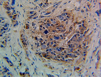 Anti-Blood Group Lewis y antibody [F3]