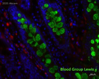 Immunohistochemistry (Formalin/PFA-fixed paraffin-embedded sections) - Anti-Blood Group Lewis y antibody [F3] (AB3359)