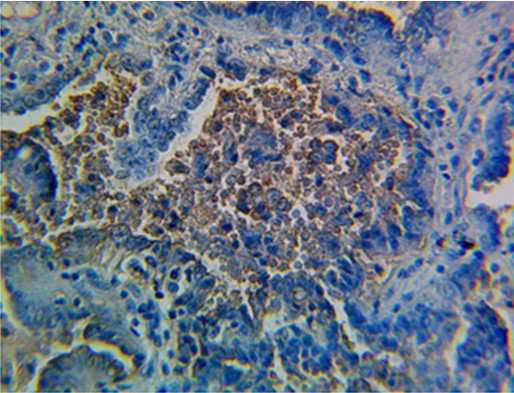 Immunohistochemistry (Formalin/PFA-fixed paraffin-embedded sections) - Anti-Blood Group Lewis y antibody [F3] (AB3359)