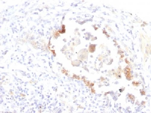 Immunohistochemistry (Formalin/PFA-fixed paraffin-embedded sections) - Anti-Blood Group Lewis y antibody [LWY/1463] (AB219336), expandable thumbnail
