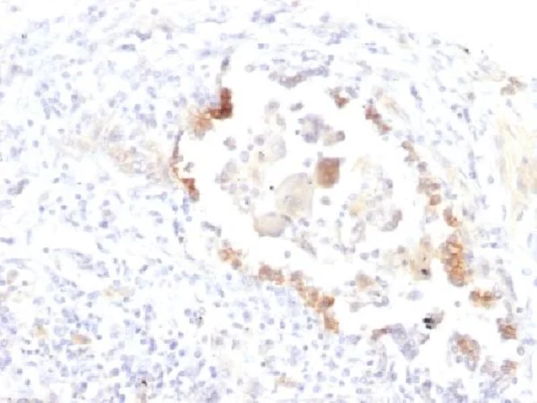 Immunohistochemistry (Formalin/PFA-fixed paraffin-embedded sections) - Anti-Blood Group Lewis y antibody [LWY/1463] (AB219336)