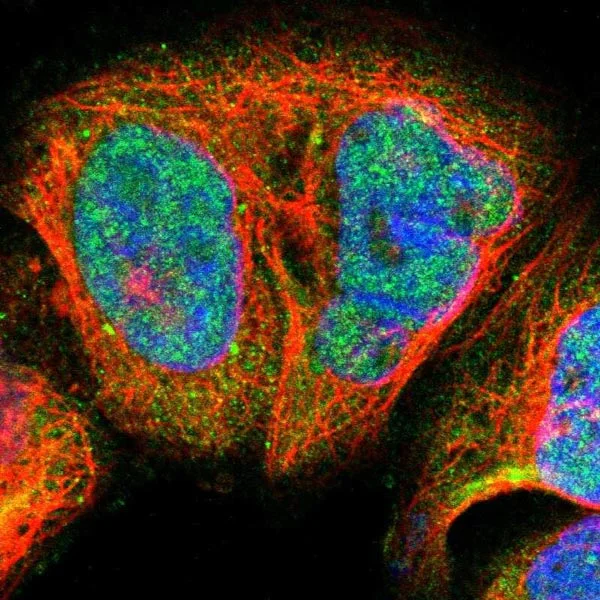 Immunocytochemistry/ Immunofluorescence - Anti-Blooms Syndrome Protein Blm antibody (AB223734)