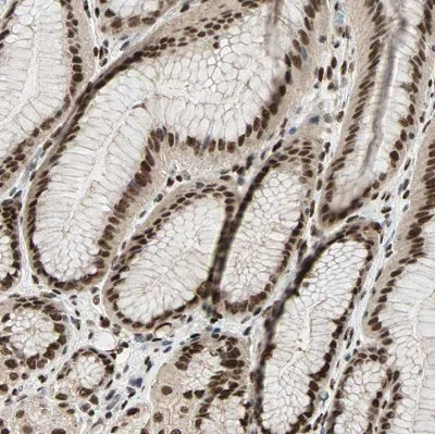 Immunohistochemistry (Formalin/PFA-fixed paraffin-embedded sections) - Anti-Blooms Syndrome Protein Blm antibody (AB223734)