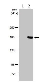 Western blot - Anti-Blooms Syndrome Protein Blm antibody (AB226945)