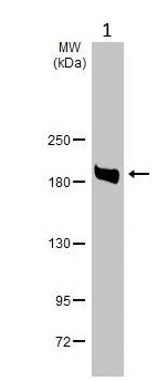 Western blot - Anti-Blooms Syndrome Protein Blm antibody (AB226945)